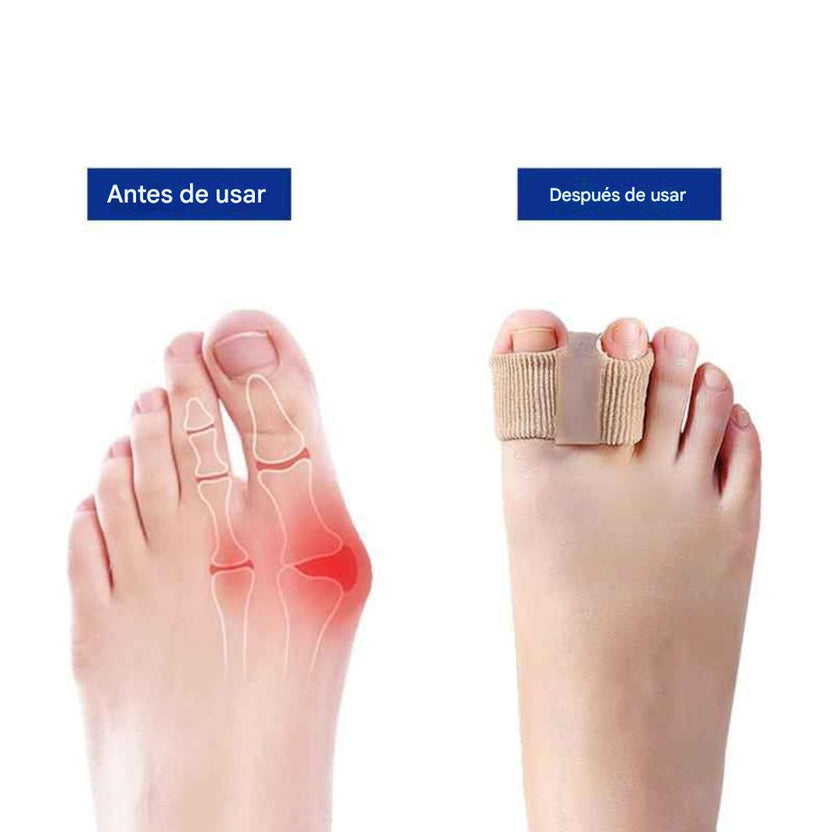 Par Separadores de dedos alivio del dolor y alineación cómodos